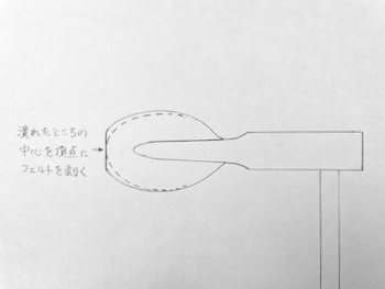 弦溝の頂点を中心としてファイリングする